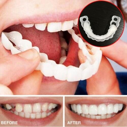 Whitening Tooth Braces Denture Care False Dental Tooth Upper Teeth Whitening Dental Snap On Smile One Size Fits Most Comfortable