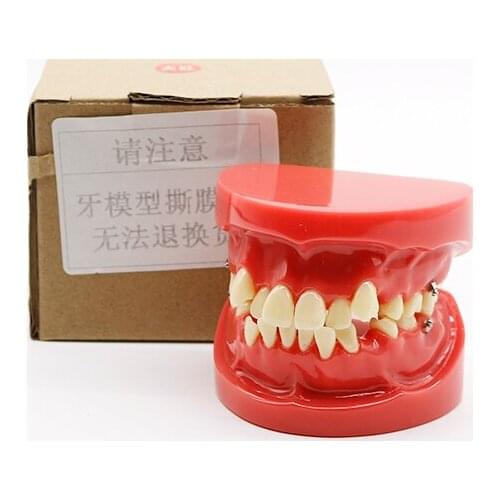Dental Orthodontic Model Semi-metal Bracket Standard Model Correction Practice Doctor-patient Communication Teaching Model