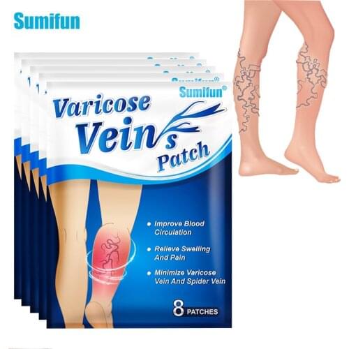 40Pcs/5Bags Sumifun New Varicose Veins Patch Thigh Blood Vessel Swelling Phlebitis Vasculitis Sticker Pain Relief Care Plaster