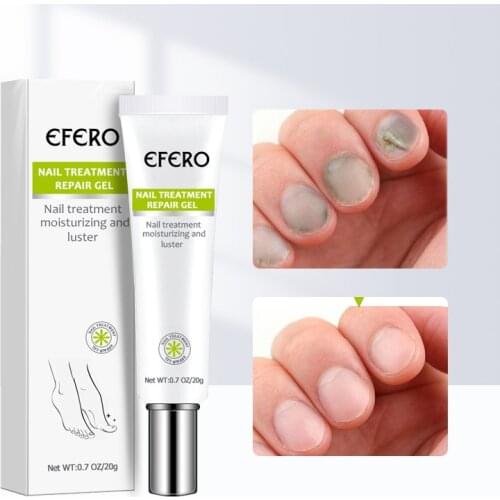 Nail Repair Cream Painless Nail Fungus Removal Anti Onychomycosis Paronychia Feet Care Treatment Anti Fungal Toe Repair Cream