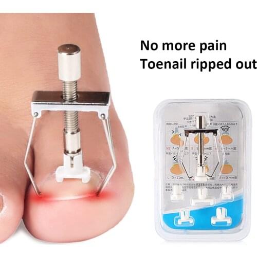 Ingrown Nail Recover Kit Pedicure Orthotic Toenail Fixer Curly Nail Correction Foot Embed Nails Care Corrector Tool Set