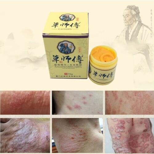 Eczema Psoriasis Pruritus Antibacterial Dermatitis Herbal Cream 10g CaoShiFu Anti-itching body hand foot care Ointment