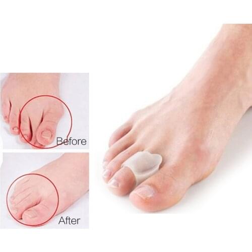 2Pcs=1Pair Silicone Toes Separators Orthopedic Concealer Thumb Hallux Valgus Corrector Pedicure Device Bunion Adjuster Foot Care