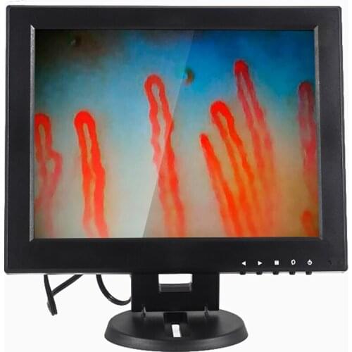 12 inches Microcirculation diagnosis microscope Blood vessel microcirculation test Analyzer