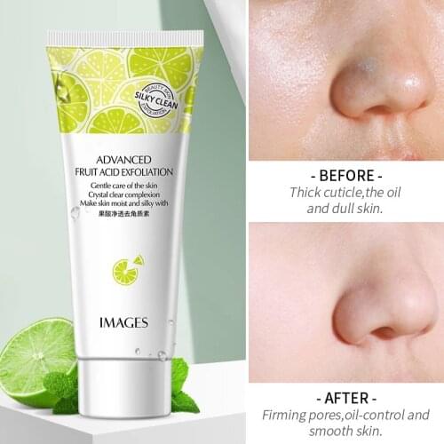Exfoliating Face Scrub Peeling Gel Moisturizing Whitening Lemon Vitamin C Alpha Hydroxy Acid Remove Acne Detoxifies Cream