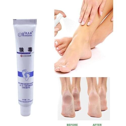 20ml Athletes Foot Antibacterial Cream Foot Cream Itchy Peeling Foot Blisters Feet Beriberi For Athlete Ointm Care Feet Er U3J0