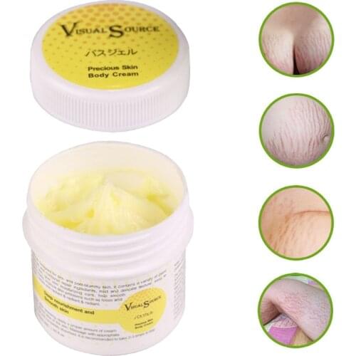 Stretch Mark Smooth Repair Cream Postpartum Pregnancy Scar Removal Skin Care MH88
