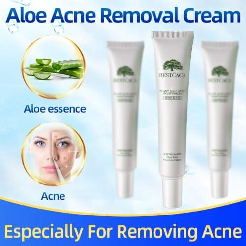 Plant aloe Anti-acne Cream Treatment Fade Acne Spots Oil Control Shrink Pores Scar Skin Care Moisturizer