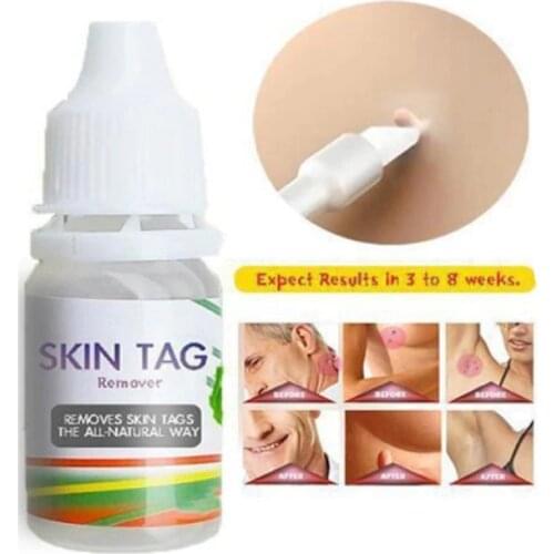 Foot Corn Blackhead Remover Mole Genital Wart Natural Skin Tag Remover Chinese Medicine Treatment Ointment TSLM1