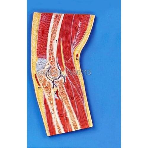 Elbow Joint Section Model, Anatomical Elbow Joint Model