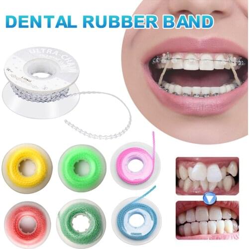 Dental Rubber Chain Orthodontic Elastic Ultra Power Chain High Strength Rubber Band Materials High Strength Rubber Oral Care