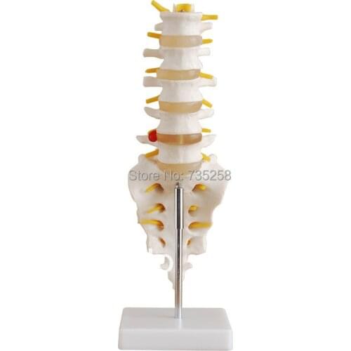 Life-Size Lumbar Vertebrae with Sacrum & Coccyx and Herniated Disc model