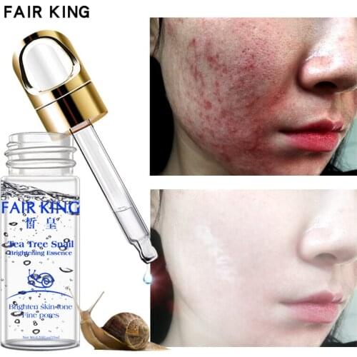 FAIR KING Snail Serum Hyaluronic Acid Serum Moisturizing Whitening Lifting Firming Serum Anti-Aging Face Skin Care
