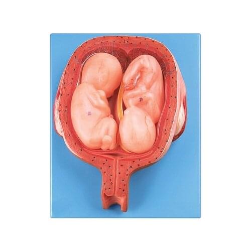 Five-month twin model Fetal development Gynecologist demonstrates simulation model natural size free shipping