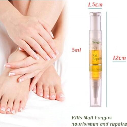 5ml Fungal Nail Treatment Pen Onychomycosis Paronychia Anti Fungal Nail Infection Toe Nail Fungus Treatment TSLM2