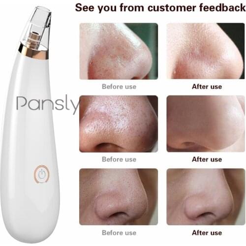 Face Nose Acne Black Dot Pimple Blackhead Remover Electric Blackhead Vacuum Cleaner Pore Blackhead Skin Care Tools Machine