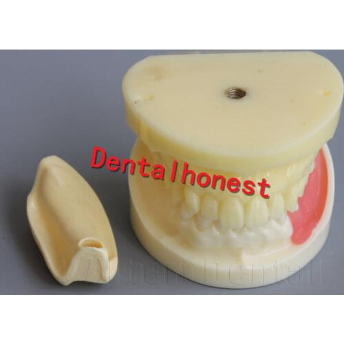 Dental Full Implant Drilling Practice Teeth Study Model Typodont Model 2002-01