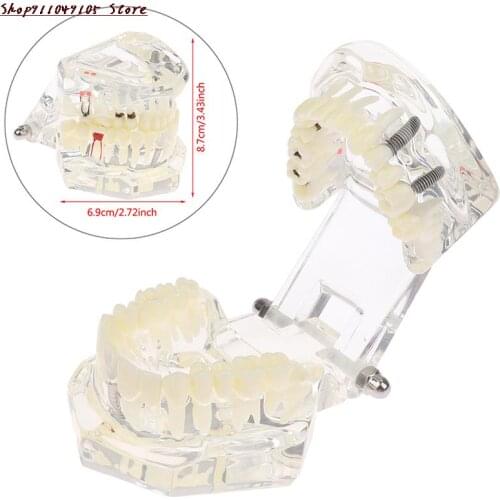 KuZHEN Dental Materials
