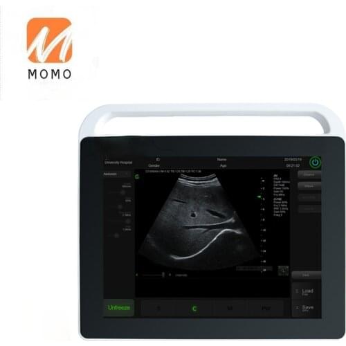 Tablet 15" touch display medical ultrasound echographie portable