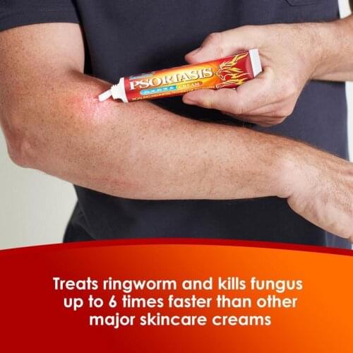 Traditional Herbal Psoriasis Cream Antibacterial Cream Relief Urticaria Eczema Anti-itch Itching Ointment Skin Treatment Ra D4Q6