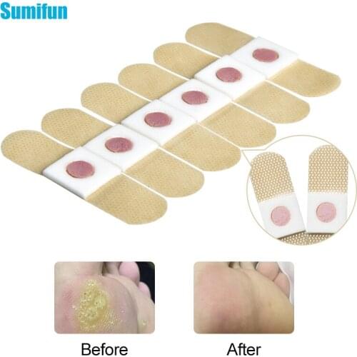 120pcs Foot Corn Removal Medical Plaster Foot Care Calluses Plantar Warts Thorn Killer Pain Relieving Patches Health Care D2950