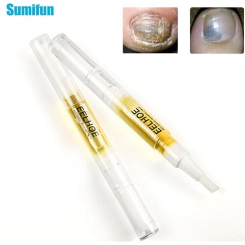1Pcs 3ml Nail Repair Liquid Anti-fungal Treatment Oil Set Onychomycosis Paronychia Antibacterial Treatment Nails Care Plaster