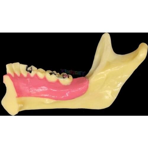 1PC Dental Mandibular Teeth Demonstration Anatomical Patient Study Teaching Model