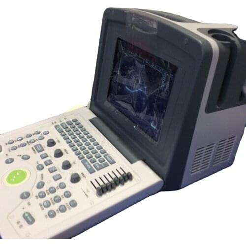 S-830 Portable Ultrasound scanner