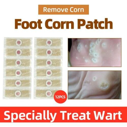 12/24/36/48PC Foot Corn Removal Warts stickers Toe Thorn Pain Relief Patch Meat Thorn Warts Medical Plaster Skin Removal Warts