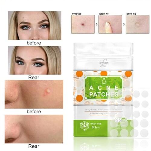Sevich 25PCS Acne Patch Artificial Skin Care Waterproof Acne Removal Pimple Patch Invisible Stickers Acne Pimple Removal TSLM2