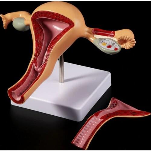 Human Pathological Uterus Ovary Model Anatomical Anatomy Disease Pathology Lesion For Teaching