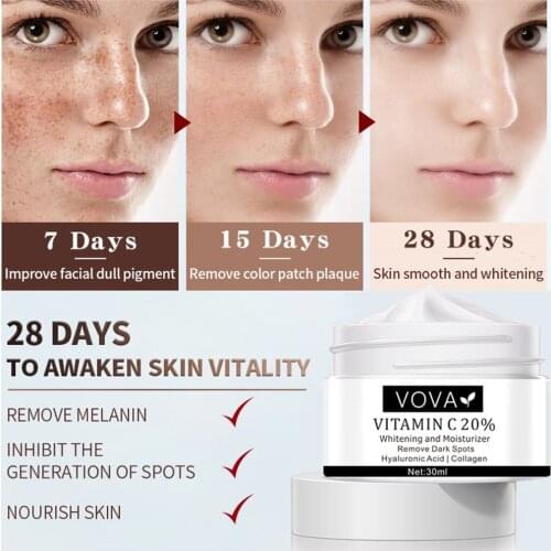 VOVA Effective Whitening Freckle Cream Rich in Vitamin C for Removing Melasma Acne Dark Spots Pigmentation Moisturizing Gel