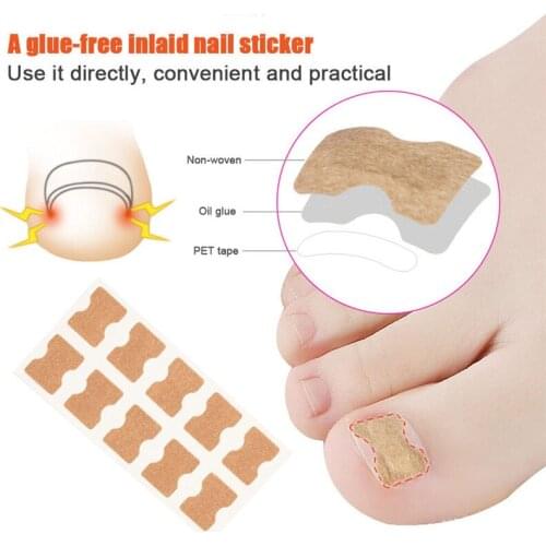 2/5Pcs Glue-free Toe Nail Inlay Corrector Positive Nail Strip Anti-roll Nail-free Nail Patch Pull Manicure Foot Care
