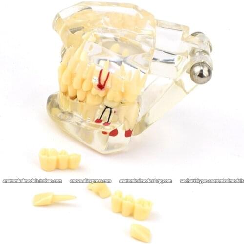 12629/CMAM Human tooth model anatomy