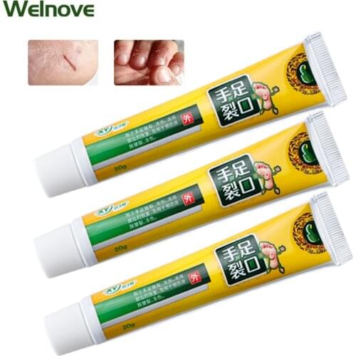 3Pcs Anti Crack Hand Foot Cream Foot Dryness Mask Heel Cracked Repair Cream Hand Moisturizing Removal Callus Dead Skin Feet Care