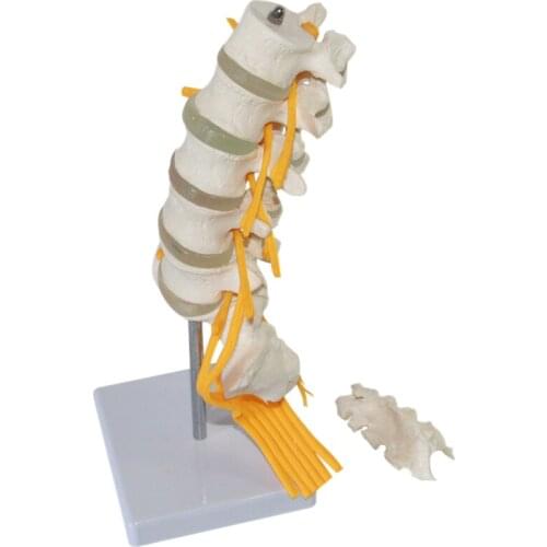 Human lumbar vertebrae with cauda equina model spinal disc herniation lumbar vertebrae