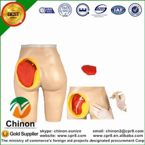 Chinon Advanced Anatomical Structure Hip Muscle Injection Model Medical Science Education Student Teaching Tools BIX-H4T