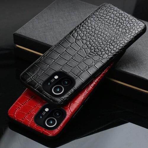 J DC Xiaomi Mi 11 Phone Cases