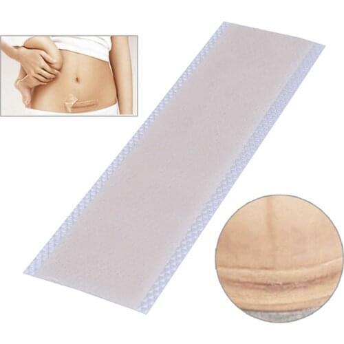 Silicone Scar Removal Patch Remove Trauma Burn Scar Sheet Skin Repair Scar Removal Therapy Patch for Acne Scar Treatment