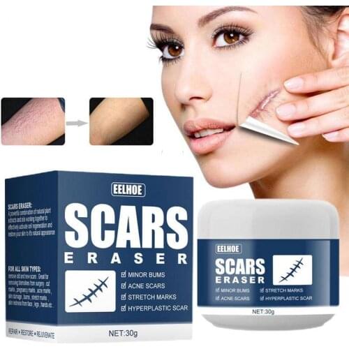 30g Scar Removal Cream Stretch Marks Gel Skin Repair Face Cream Surgical Burn Scar Acne Remove Smoothing Whitening BodySkin Care