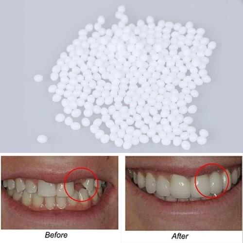 5/10/15/20g Temporary Tooth Repair Kit Teeth And Gaps FalseTeeth Solid Glue Denture Adhesive Teeth Whitening Tooth Beauty Tool