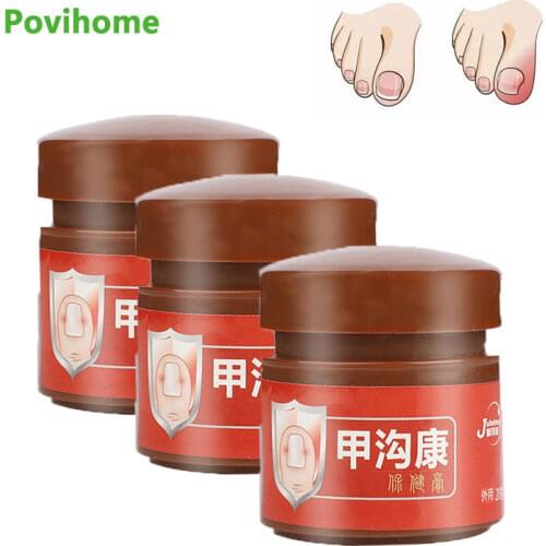 20g Fungal Nail Repair Removal Cream Remove Gel Anti Infection Paronychia Ointment Onychomycosis Herbal Medical Plaster