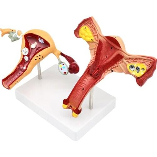 Female reproductive uterus Vagina pathological ovary teaching model Gynecological reproductive teaching aids