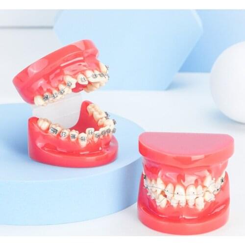 Dental Orthodontic Tooth Model Standard Oral Teaching Aids Doctor-Patient Communication Exam Practice Bracket Simulation
