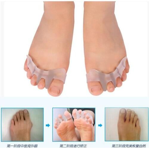 2Pcs Silicone Thumb Separation Orthosis 4 Holes Foot Care Toe Separator Divider Thumb Bunion Hallux Valgus Correction Protector