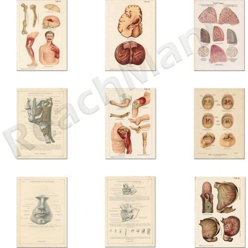 Doctor patent printing, brain, hand, foot, muscular system anatomical structure anatomy printing, medical hospital art clinic wa