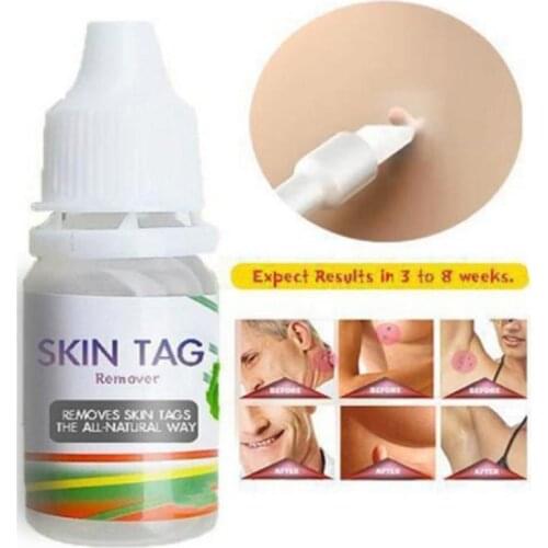 10ML Skin Tag Remover Against Mole & Genital Wart Fast RemovWithin Al Anti Foot Corn Removal Warts Papillomas Rapidly Removes
