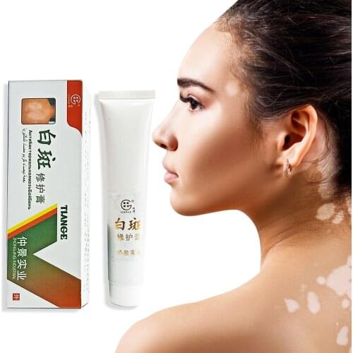 30g Chinese Vitiligo Cream White Spot Antibacterial Cream Pigment Melanin Promoting Skin Vitiligo Treatment Health Plaster