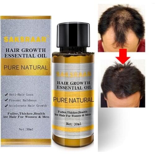 30ml Natural Hair Growth Essential Oils Essence Original Authentic 100% Hair Loss Liquid Health Care Dense Hair Growth Serum Hot
