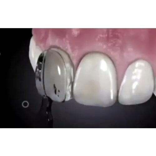 30Pcs Dental Mould Composite Resin Light Cure Anterior Front Teeth Fast Quick